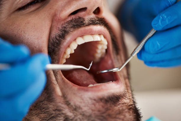 Emergency Gum Pain Relief in ID